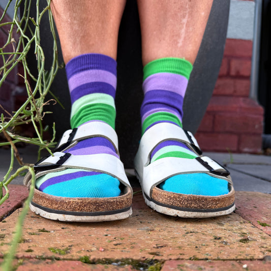 A close-up of a person's feet wearing colorful striped socks and white slide sandals with bright blue toes, standing on red brick pavers outdoors.